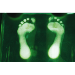 Speilkasse med LED lys